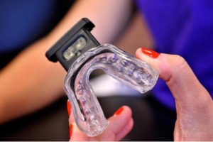 This smart mouthguard could reduce the damage of concussions during play